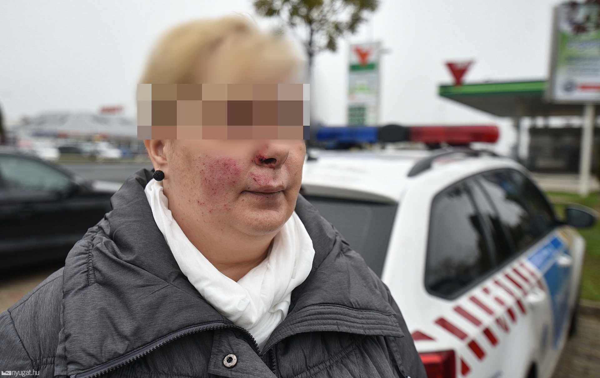Családanyát lőtt arcon a dohánybolti rabló